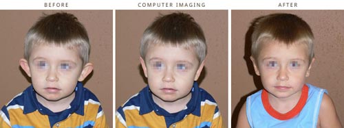 Computer Imaging