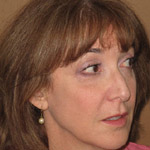 Sculptra - Before And After Pictueres